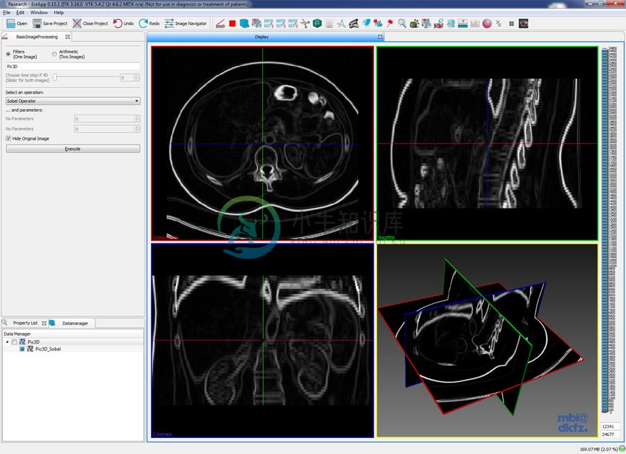 mitkbasicimageprocessing.png